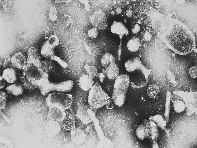 تصویر میکروسکوپی از ویروس FLV در گربه‌