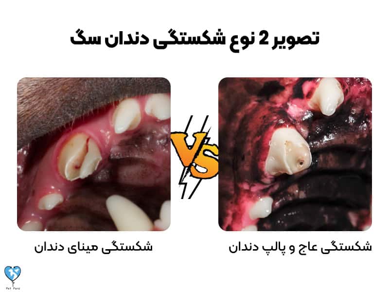 مقایسه انواع شکستگی دندان سگ‌